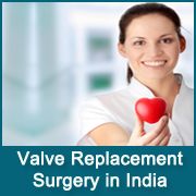 Top Doctors for Mitral Valve Repair in India